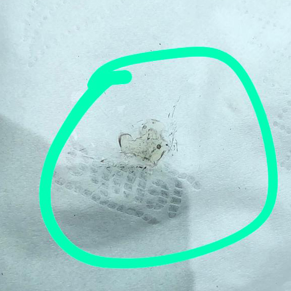 個案六 · 自行用膠水填補